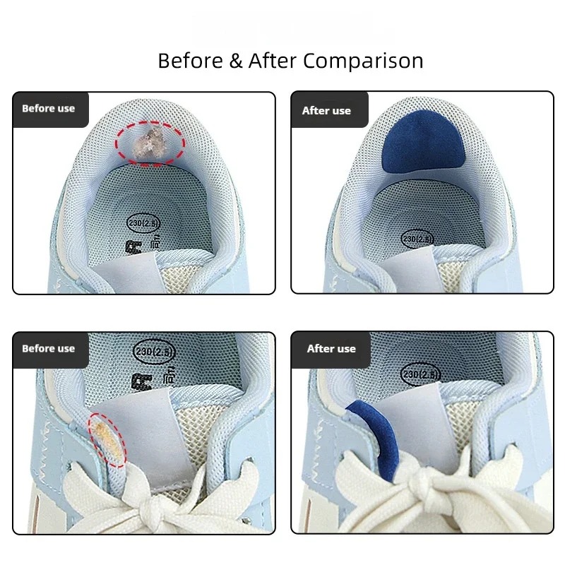 6Pcs Shoe Repair Patches Anti  - Sneaker Care Service review and price